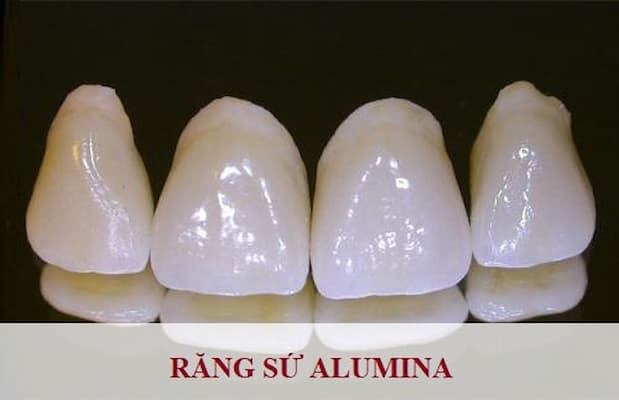 loại răng toàn sứ alumina
