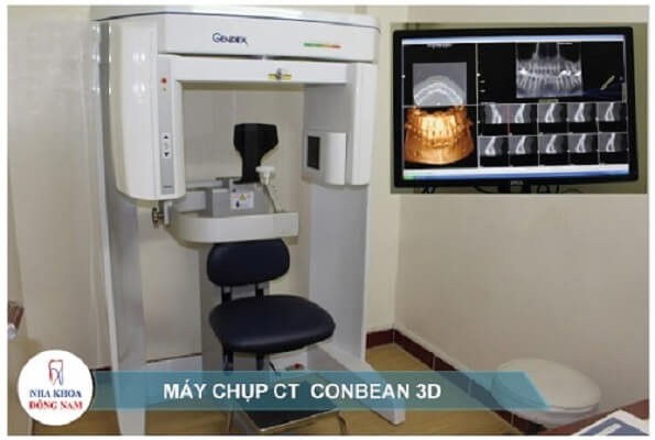 Máy Chụp Ct Conbean 3d Tại Trung Tâm Cấy Implant