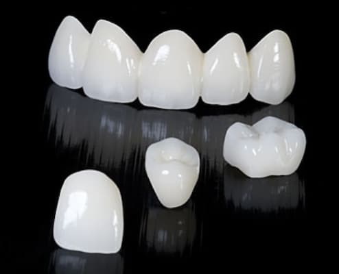 răng toàn sứ emax zirconia