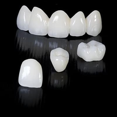 ưu điểm nổi bật của dòng răng toàn sứ